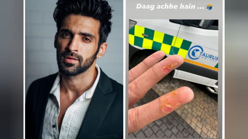 Arjit Taneja sprains his fingers while performing stunts; the actor posts an image on social media
